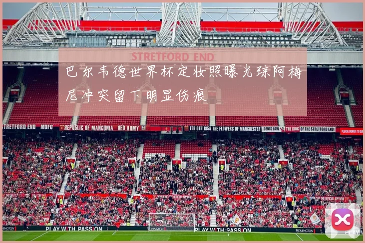 巴尔韦德世界杯定妆照曝光琼阿梅尼冲突留下明显伤痕